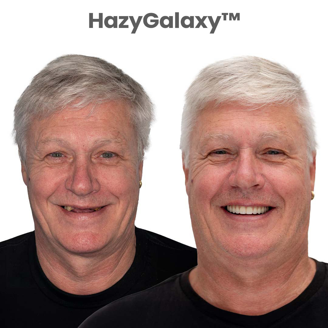 🦷 HazyGalaxy™ Custom-Fit Dentures ⏰ ENDS TODAY 88% OFF | Smile with Confidence