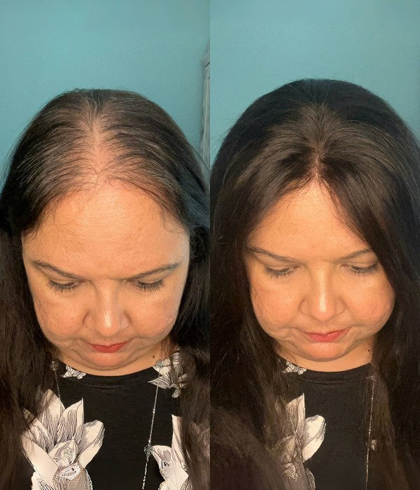 🔥 Final Hours —8.5” x 9” Ultra-Breathable Human Hair Topper | Low Density| Ponytail Friendly