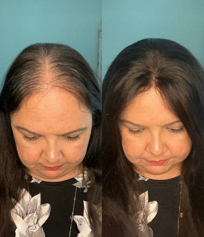 🔥 Final Hours —8.5” x 9” Ultra-Breathable Human Hair Topper | Low Density| Ponytail Friendly