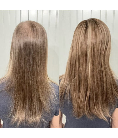 🔥 Final Hours —8.5” x 9” Ultra-Breathable Human Hair Topper | Low Density| Ponytail Friendly