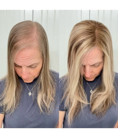 🔥 Final Hours —8.5” x 9” Ultra-Breathable Human Hair Topper | Low Density| Ponytail Friendly