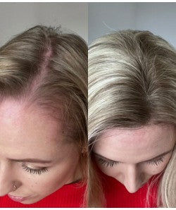 🔥 Final Hours —8.5” x 9” Ultra-Breathable Human Hair Topper | Low Density| Ponytail Friendly
