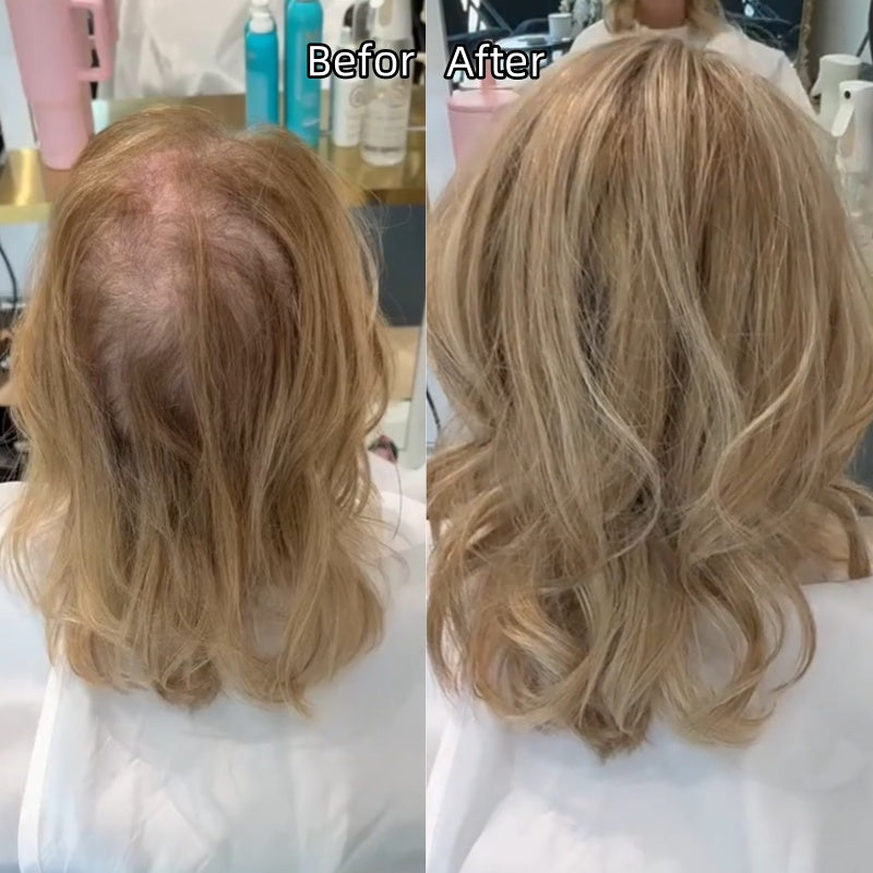 Final Hours –🌷2026 New Lightweight & Breathable Wavy Hair Topper